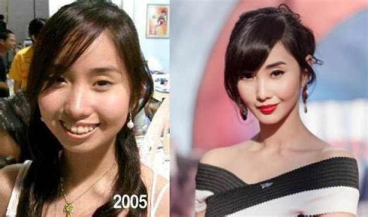 Alodia Gosiengfiao Plastic Surgery Before And After Photos