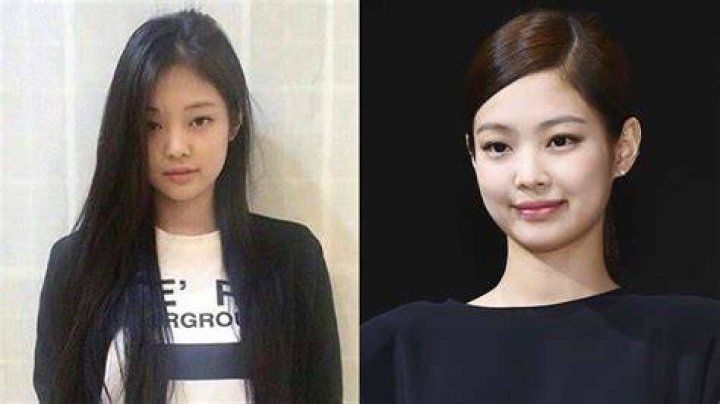 BLACKPINK&rsquo;s Jennie, Jisoo Before and After Alleged Plastic Surgery