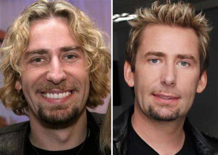 Chad Kroeger&rsquo;s Plastic Surgery The 48YearOld Canadian Singer&rsquo;s
