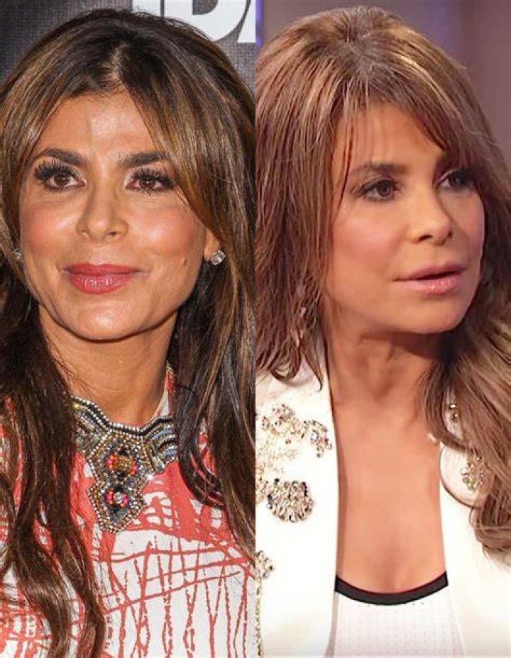 Did Paula Abdul Have Plastic Surgery? Everything You Need To Know