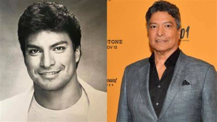 Gil Birmingham&rsquo;s Plastic Surgery Did the Yellowstone Cast Undergo
