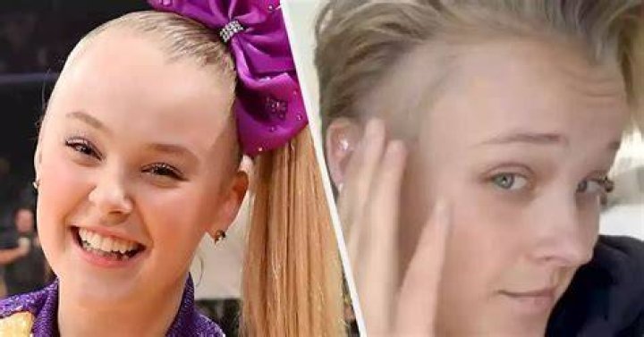 JoJo Siwa Reveals &ldquo;Bald Spot&rdquo; and Stress Rash From Dance Moms