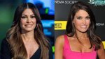 Kimberly Guilfoyle Before and After: a Comprehensive Look at Her Transformation
