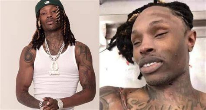 King Von Autopsy Photos Leaked! Here Is All You Need To Know