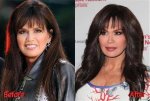 Marie Osmond Facelift and Plastic Surgery Before and After Pics, Age and Height |