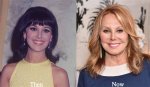 Marlo Thomas's Plastic Surgery Journey