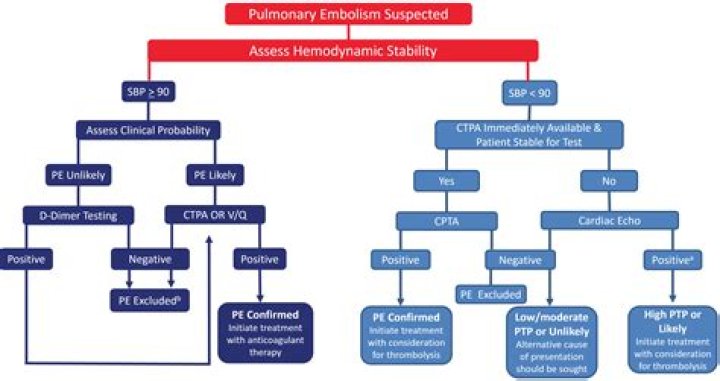 New Diagnostic Algorithm May Rule Out Deep Vein Thrombosis, Reduce