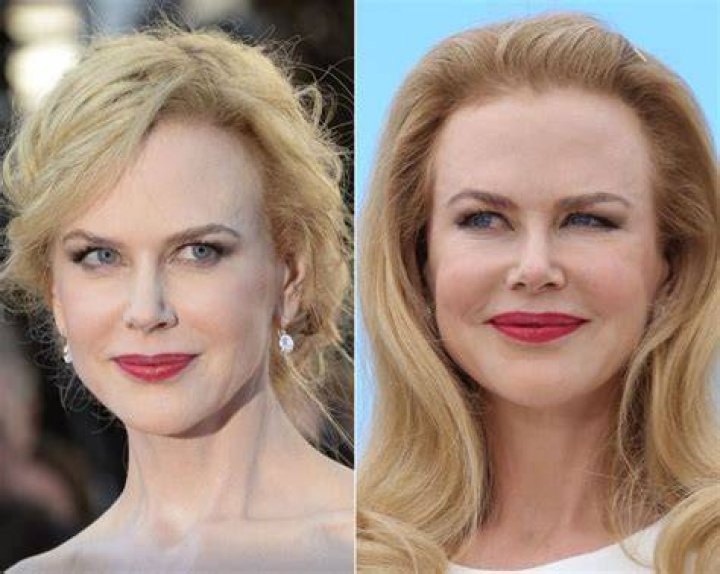 Nicole Kidman Before And After Telegraph
