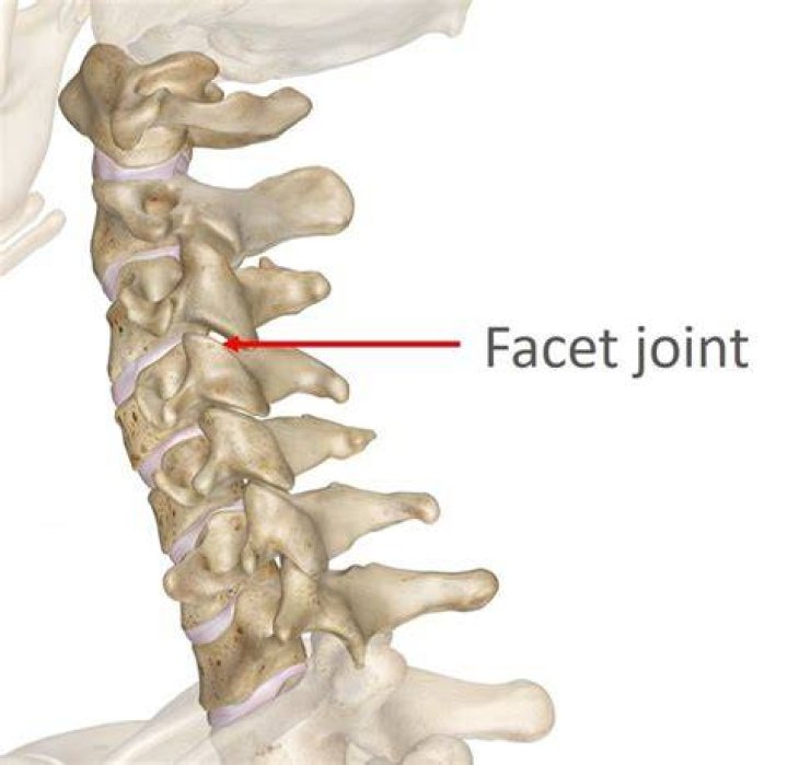 Painful Facet Joints? It Could Be Hypertrophy