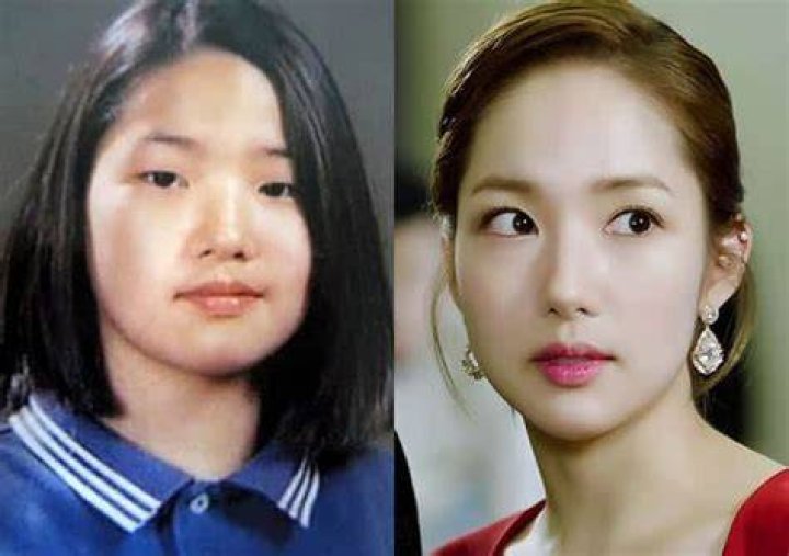 Park Minyoung before and after YouTube