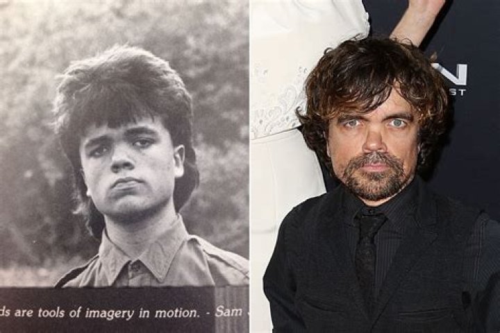 Peter Dinklage (Part 1) BULB