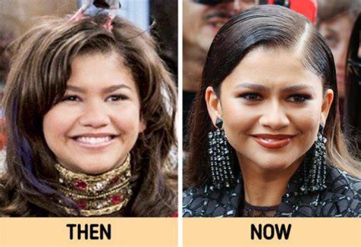 Then and now Stars of 'Ningning' and 'Honesto' are back ABSCBN News