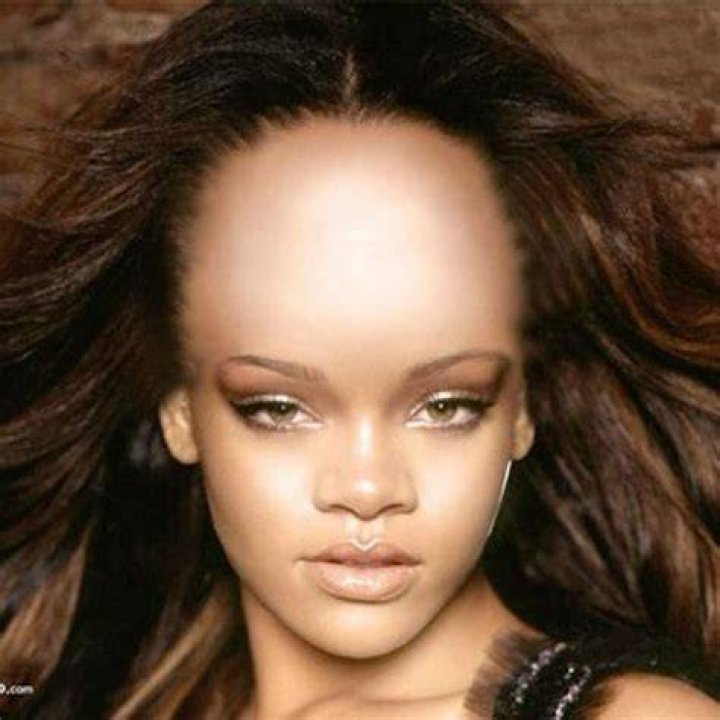 Who has the biggest forehead in the world? Hedge the book