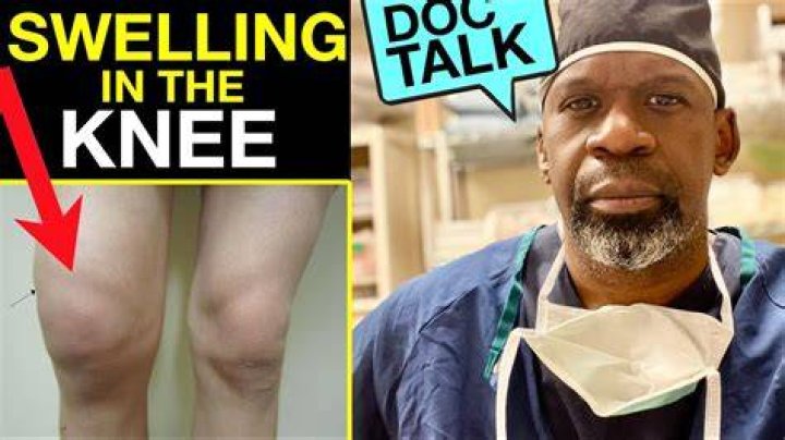 Why Is My Knee Swelling Without Pain? Causes Explored