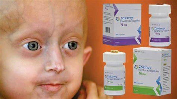 Zokinvy First drug for progeria, a rare rapidaging disease, extends